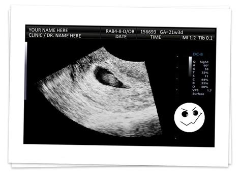 fake ultrasound pictures|make a real ultrasound.